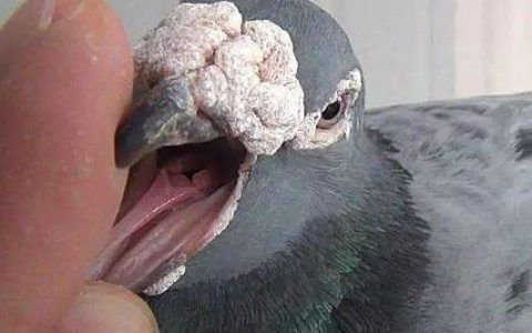 鼻瘤